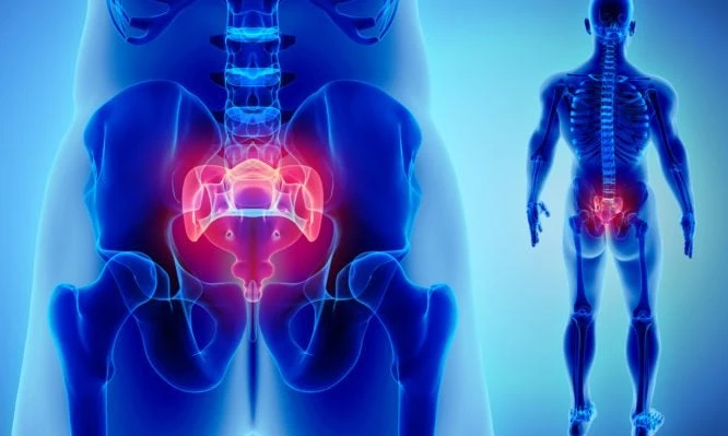 Κύστη κόκκυγος: Διάγνωση και θεραπεία